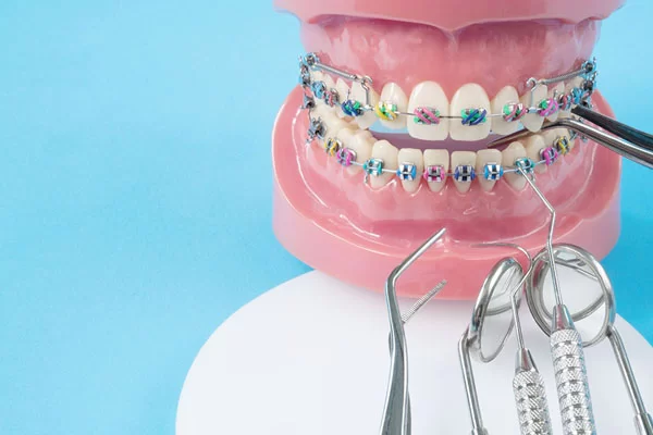 braces with dental toold next to the 3D teeth model